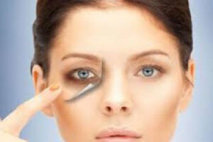 Prp Tedavisi Nedir Fiyatlari 2021 Op Dr Leyla Arvas Prp Tedavisi Nedir Fiyatlari 2021 Op Dr Leyla Arvas