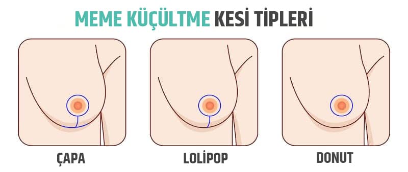 meme küçültme teknikleri
