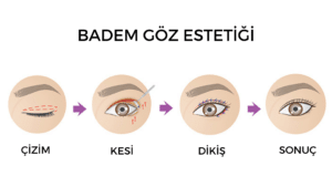 Bademgöz