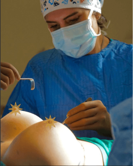 Chirurgie d’augmentation Mammaire