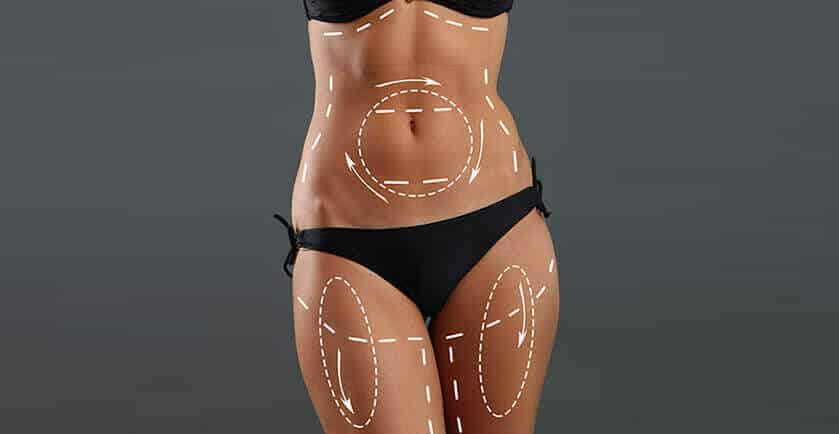 Liposuction ile Kaç Kilo Yağ Alınır