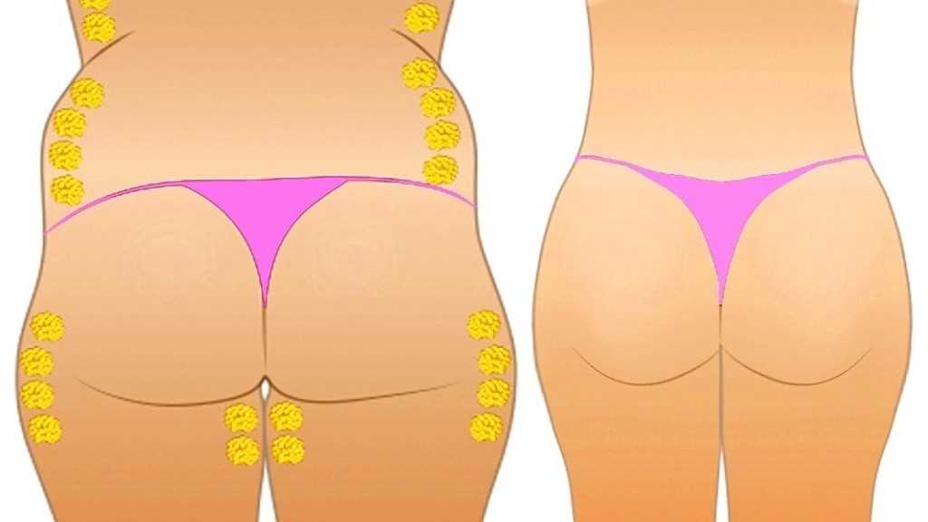 Paypoqda tor bel va keng kalçalar