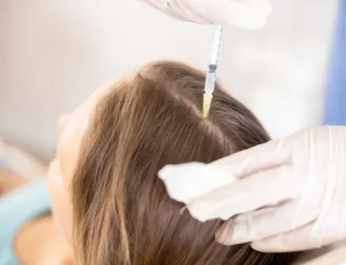 Eksozom Saç Tedavisi