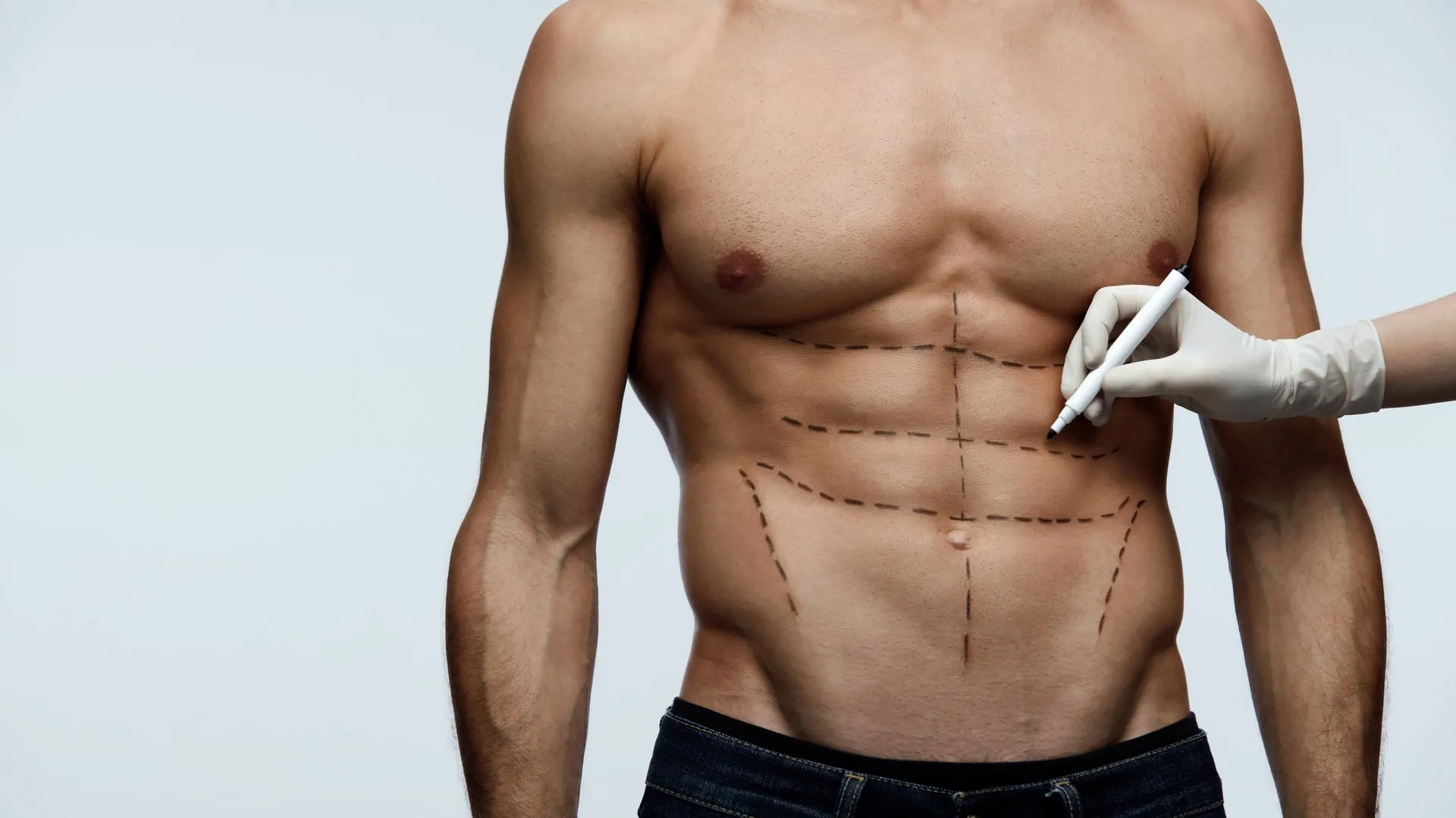 4D Liposuction