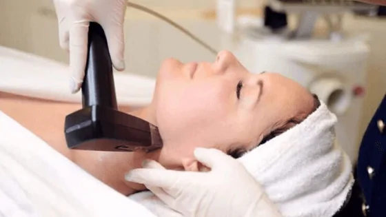 Microneedling Microneedling