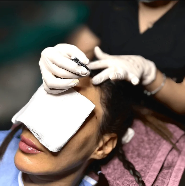 Hair Transplantation