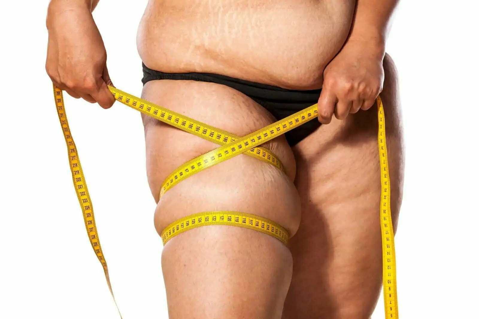 lipodem diyeti