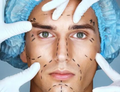 Facial Masculinization Surgery