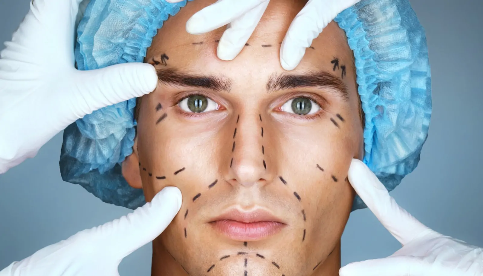 Facial Masculinization Surgery